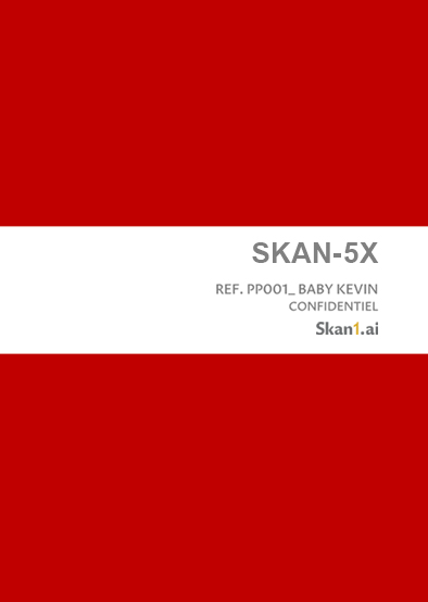 SKAN-5X assessment
